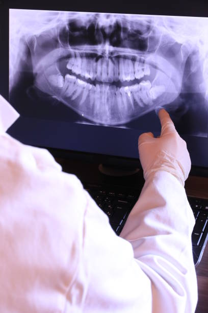 Best Emergency Wisdom Teeth Removal in Gustine, CA